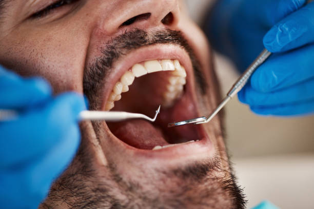 Best Cosmetic Emergency Dentistry in West Hollywood, CA